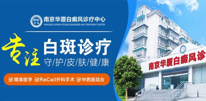 宿迁白癜风医院